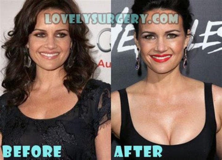 Carla Gugino Plastic Surgery Before and After