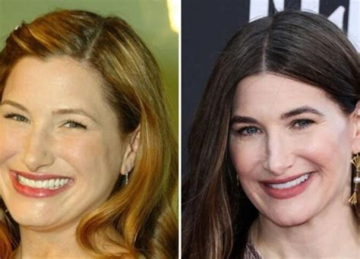 Kathryn Hahn Plastic Surgery Before and After