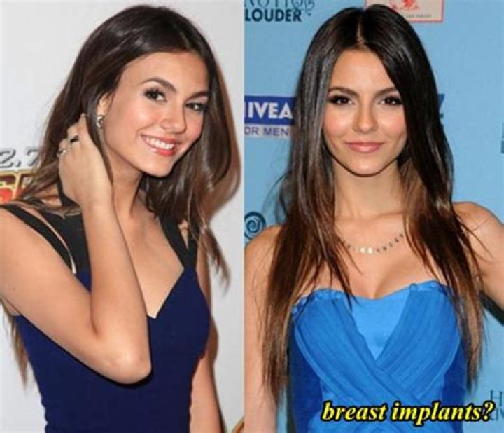 Victoria Justice Plastic Surgery Before and After